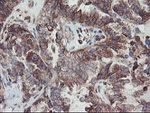 CPA2 Antibody in Immunohistochemistry (Paraffin) (IHC (P))