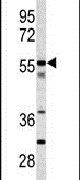 CPN2 Antibody in Western Blot (WB)