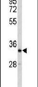 CRELD2 Antibody in Western Blot (WB)