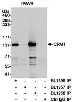 CRM1 Antibody in Immunoprecipitation (IP)