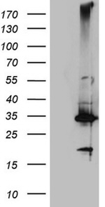 CRP Antibody in Western Blot (WB)