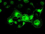 CRYAB Antibody in Immunocytochemistry (ICC/IF)