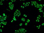 CRYAB Antibody in Immunocytochemistry (ICC/IF)