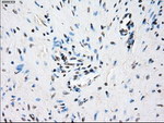 CRYAB Antibody in Immunohistochemistry (Paraffin) (IHC (P))