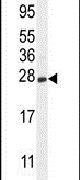 CRYGS Antibody in Western Blot (WB)