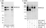 CSB/ERCC6 Antibody in Western Blot (WB)