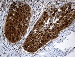 CSE1L Antibody in Immunohistochemistry (Paraffin) (IHC (P))