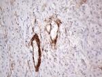 CSF2 Antibody in Immunohistochemistry (Paraffin) (IHC (P))