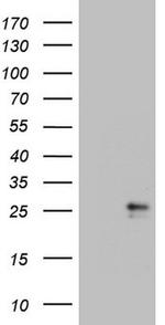 CSF2 Antibody in Western Blot (WB)