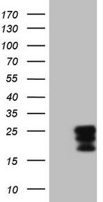 CSF2 Antibody in Western Blot (WB)