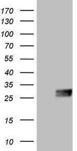 CSF2 Antibody in Western Blot (WB)