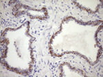 CSF2RB Antibody in Immunohistochemistry (Paraffin) (IHC (P))