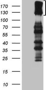 CSF2RB Antibody in Western Blot (WB)