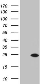 CSF3 Antibody in Western Blot (WB)