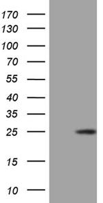 CSF3 Antibody in Western Blot (WB)