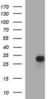 CSH1 Antibody in Western Blot (WB)