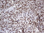 CSNK1E Antibody in Immunohistochemistry (Paraffin) (IHC (P))