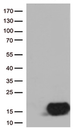 CSTB Antibody in Western Blot (WB)