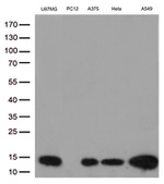 CSTB Antibody in Western Blot (WB)