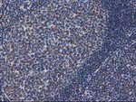 CTDSP1 Antibody in Immunohistochemistry (Paraffin) (IHC (P))