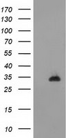 CTDSP1 Antibody in Western Blot (WB)