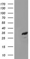 CTDSP1 Antibody in Western Blot (WB)