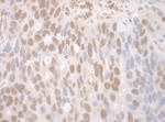 CTNNBL1 Antibody in Immunohistochemistry (IHC)