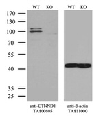 CTNND1 Antibody in Western Blot (WB)