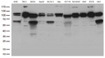 CTNND1 Antibody in Western Blot (WB)