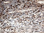 CTSL1 Antibody in Immunohistochemistry (Paraffin) (IHC (P))