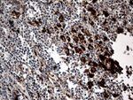 CTSL1 Antibody in Immunohistochemistry (Paraffin) (IHC (P))