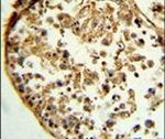 Cathepsin S Antibody in Immunohistochemistry (IHC)