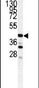 Cathepsin S Antibody in Western Blot (WB)