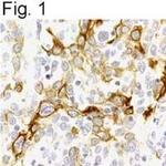 CXCR4 Antibody in Immunohistochemistry (IHC)