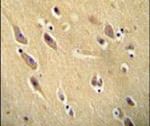 CYB561D1 Antibody in Immunohistochemistry (IHC)