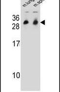 CYB561D1 Antibody in Western Blot (WB)