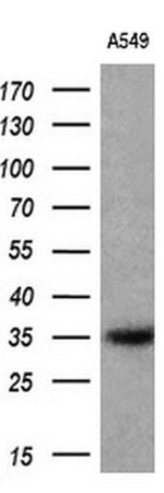 CYB5R1 Antibody in Western Blot (WB)