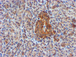 CYB5R3 Antibody in Immunohistochemistry (Paraffin) (IHC (P))