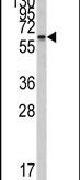 CYP26A1 Antibody in Western Blot (WB)