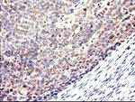 CYP2J2 Antibody in Immunohistochemistry (Paraffin) (IHC (P))