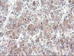 CYP2J2 Antibody in Immunohistochemistry (Paraffin) (IHC (P))