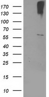 CYP2J2 Antibody in Western Blot (WB)