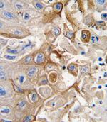 CYP2W1 Antibody in Immunohistochemistry (IHC)