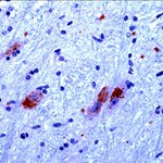 CaMKIV Antibody in Immunohistochemistry (IHC)