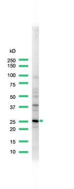 Calbindin D28K Antibody in Western Blot (WB)