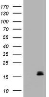 Calcitonin (CALCA) Antibody in Western Blot (WB)