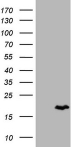 Calcitonin (CALCA) Antibody in Western Blot (WB)