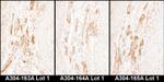 Caldesmon Antibody in Immunohistochemistry (IHC)