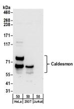 Caldesmon Antibody in Western Blot (WB)