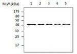 CK1 delta Antibody in Western Blot (WB)